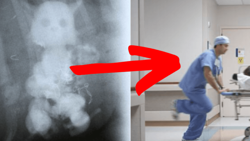 Homem é internado com urgência com uma grande boneca inserida no…Ver mais