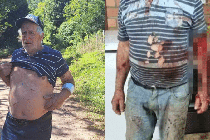Idoso de 79 anos é atacado por puma em trilha no RS; vídeo re…Veja mais