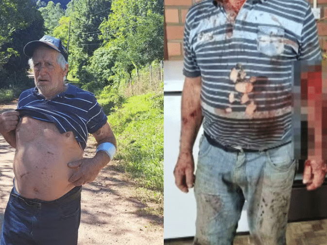 Idoso de 79 anos é atacado por puma em trilha no RS; vídeo re…Veja mais